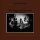 DREYBLATT, ARNOLD - NODAL EXCITATION - LP