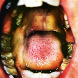 VU, HANA - PUBLIC STORAGE - LP