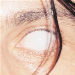 ARMLOCK - TRUST (LTD. ONYX MARBLE VINYL) - LP